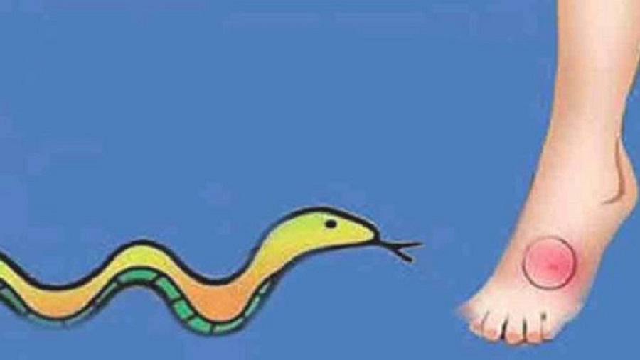 সাপের কামড়ে